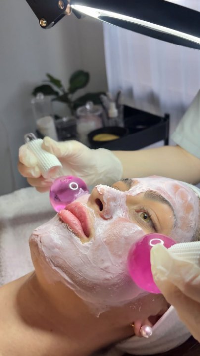 Limpieza facial profunda con criostick en MR Estética